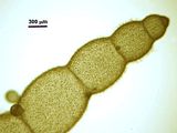 2 – Dettaglio di una ramificazione laterale con articoli doliiformi